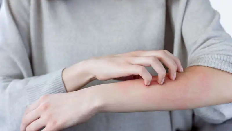 Cilt Kanserinin Gözden Kaçan İki Belirtileri: Dermatologdan Önemli Uyarılar!