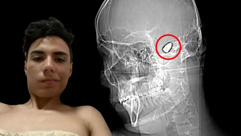 İnsanların Kafasında Patlayan Düşünceler: Psikolojinin Karanlık Yüzü
