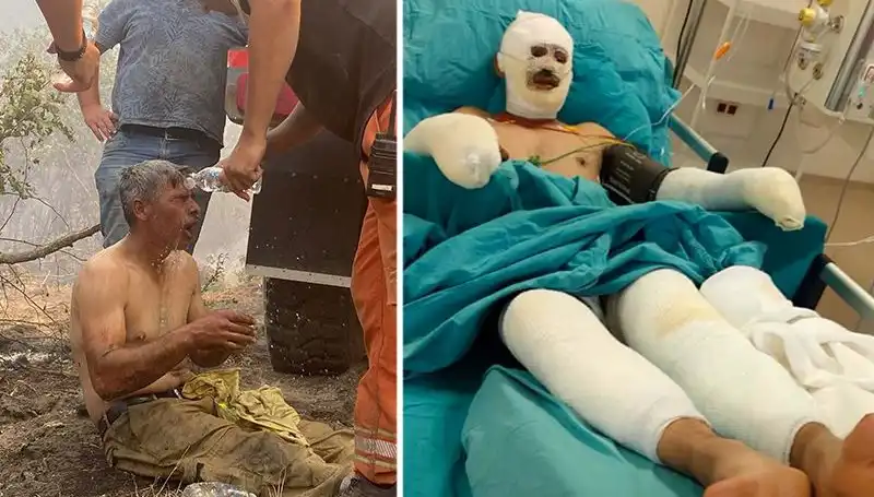 Yanıyorum Diye Feryat Eden Orman İşçisi Hastaneye Kaldırıldı!
