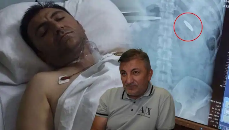 15 Temmuz’un Acı Yüzü: Vücudundaki Kurşunla 9 Yıl Geçiren Kahramanın Hikayesi