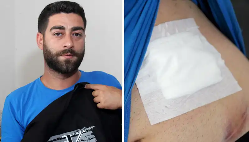 Karnındaki ağrının nedeni röntgen göründüğünde ortaya çıktı!