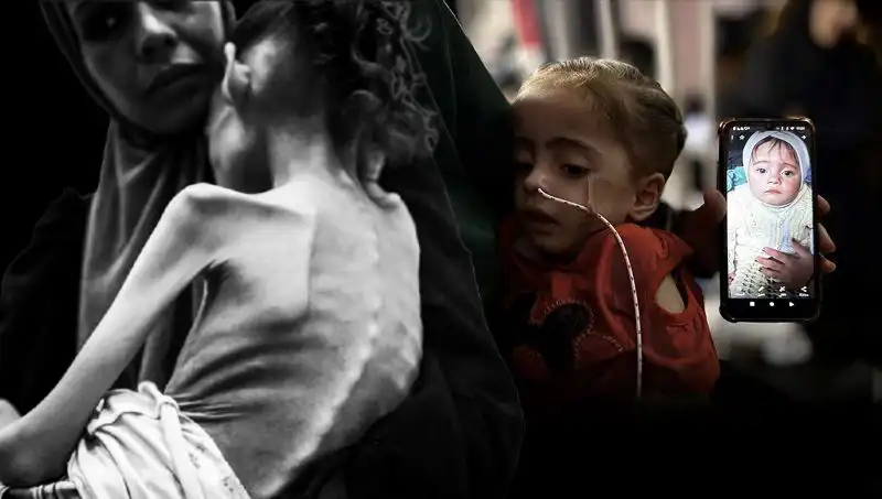 25 Kilodan 10 Kiloya Düşen Küçük Meryem'in Açlıkla Savaşımı