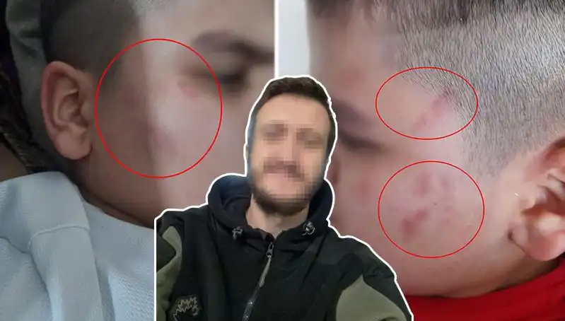 Otizmli Çocuğun Okulda Dayak Yediği İddiası Üzerine Gelişmeler